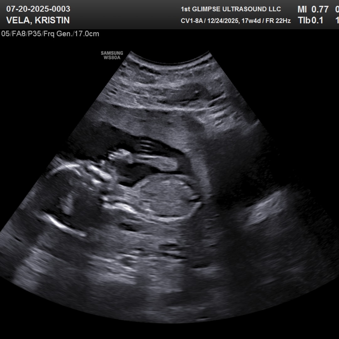 Photo shared by Kristin for their Babylist baby registry.