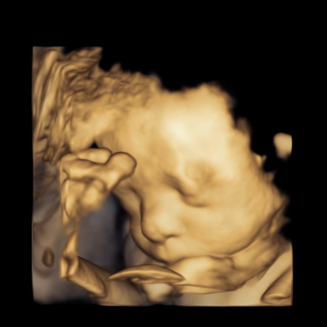 Photo shared by Alyssa for their Babylist baby registry.