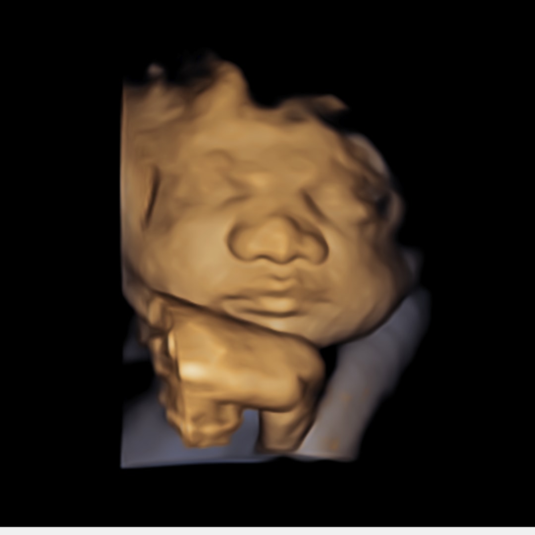 Photo shared by Elizabeth for their Babylist baby registry.