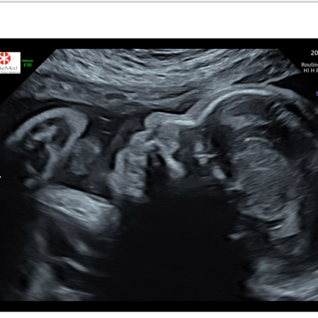 Photo shared by Meela for their Babylist baby registry.