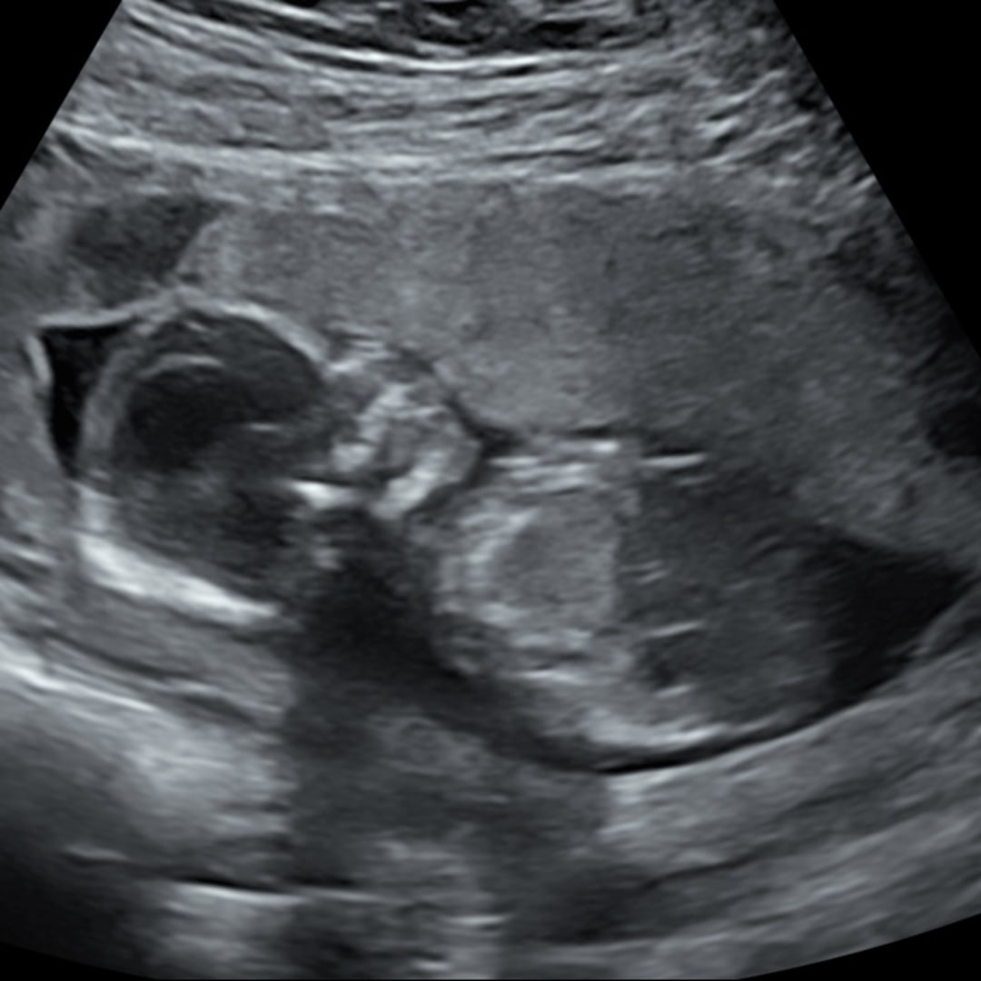 Photo shared by Kayla for their Babylist baby registry.