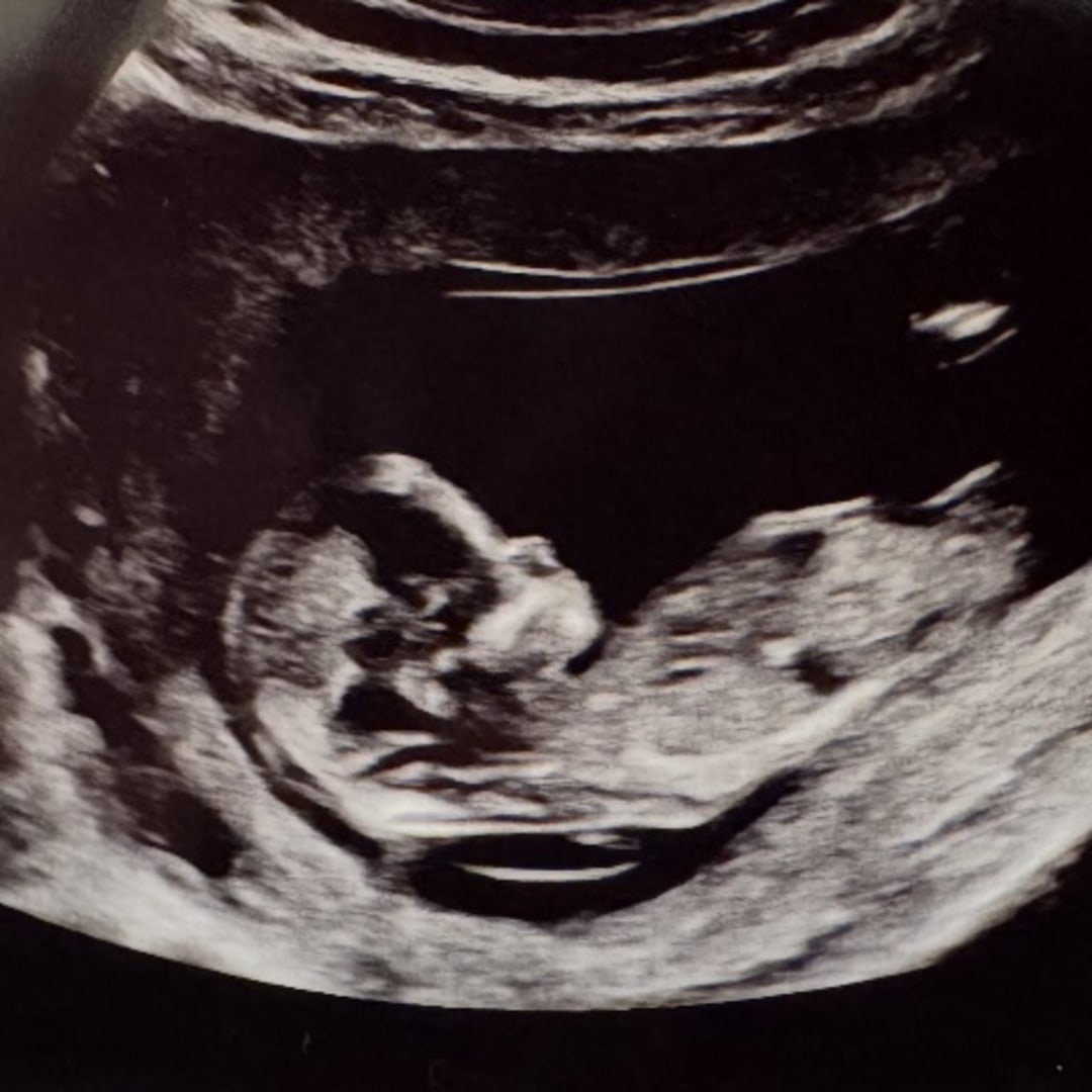 Photo shared by Marina for their Babylist baby registry.