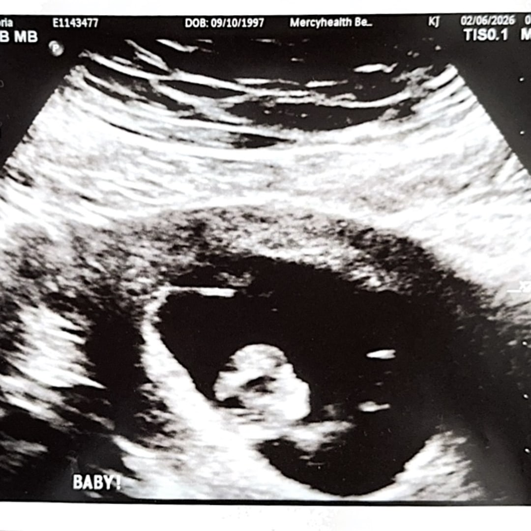 Photo shared by Victoria for their Babylist baby registry.