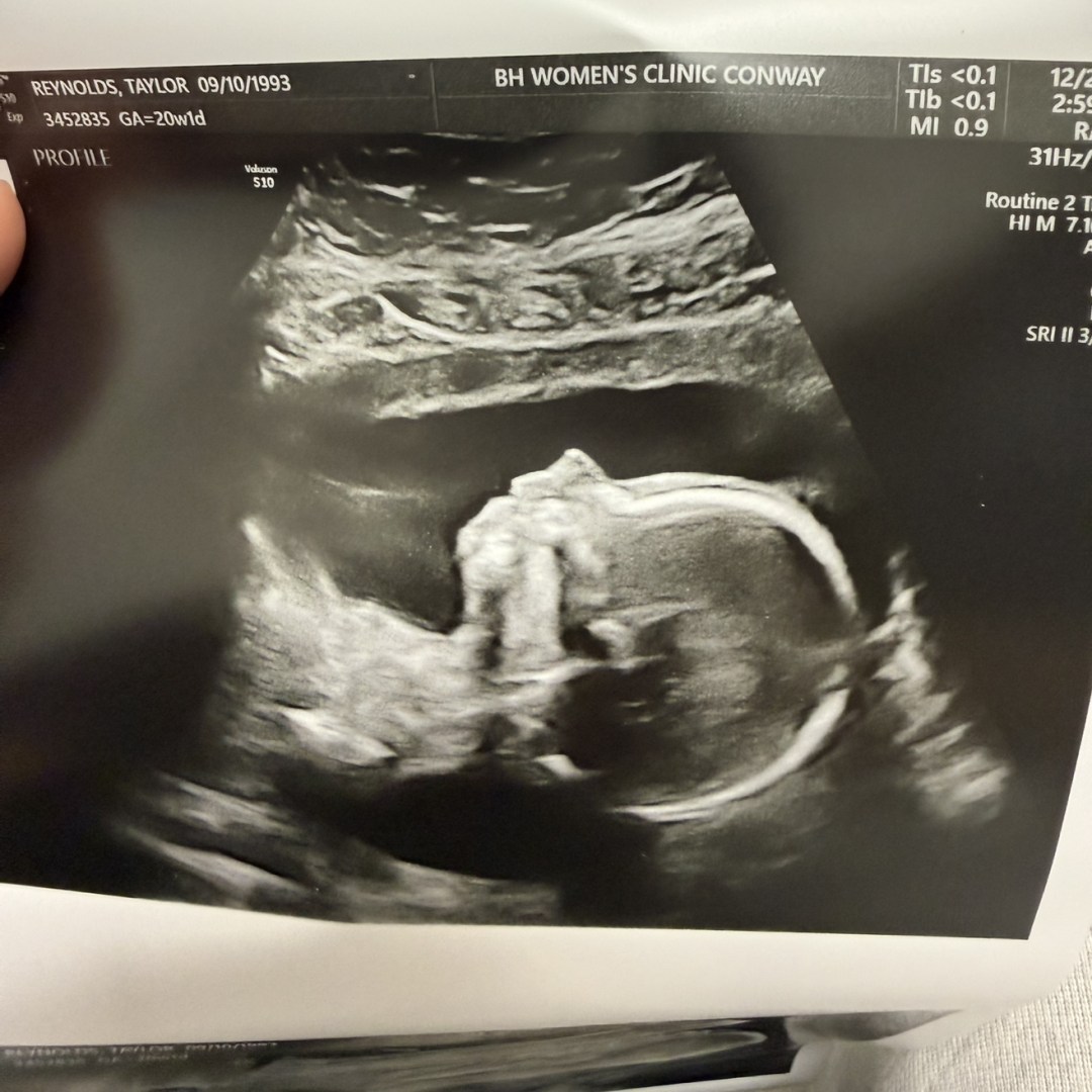 Photo shared by Taylor for their Babylist baby registry.