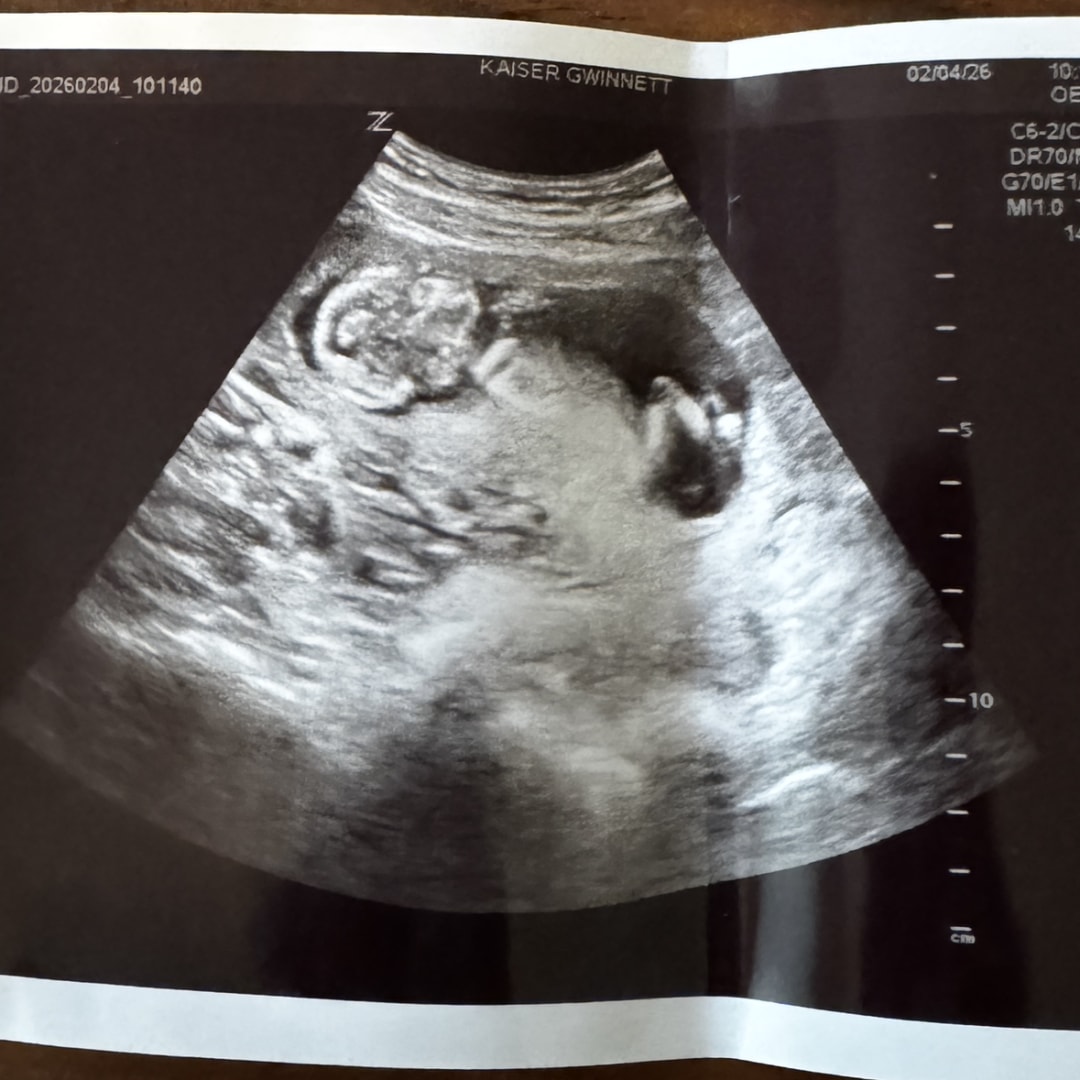 Photo shared by Rebecca for their Babylist baby registry.