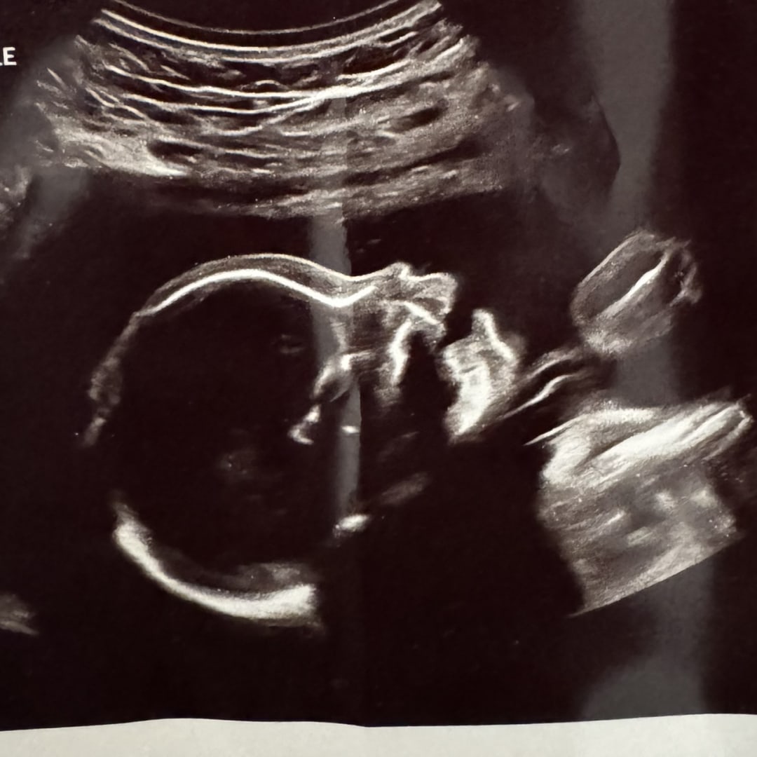 Photo shared by Hailey for their Babylist baby registry.