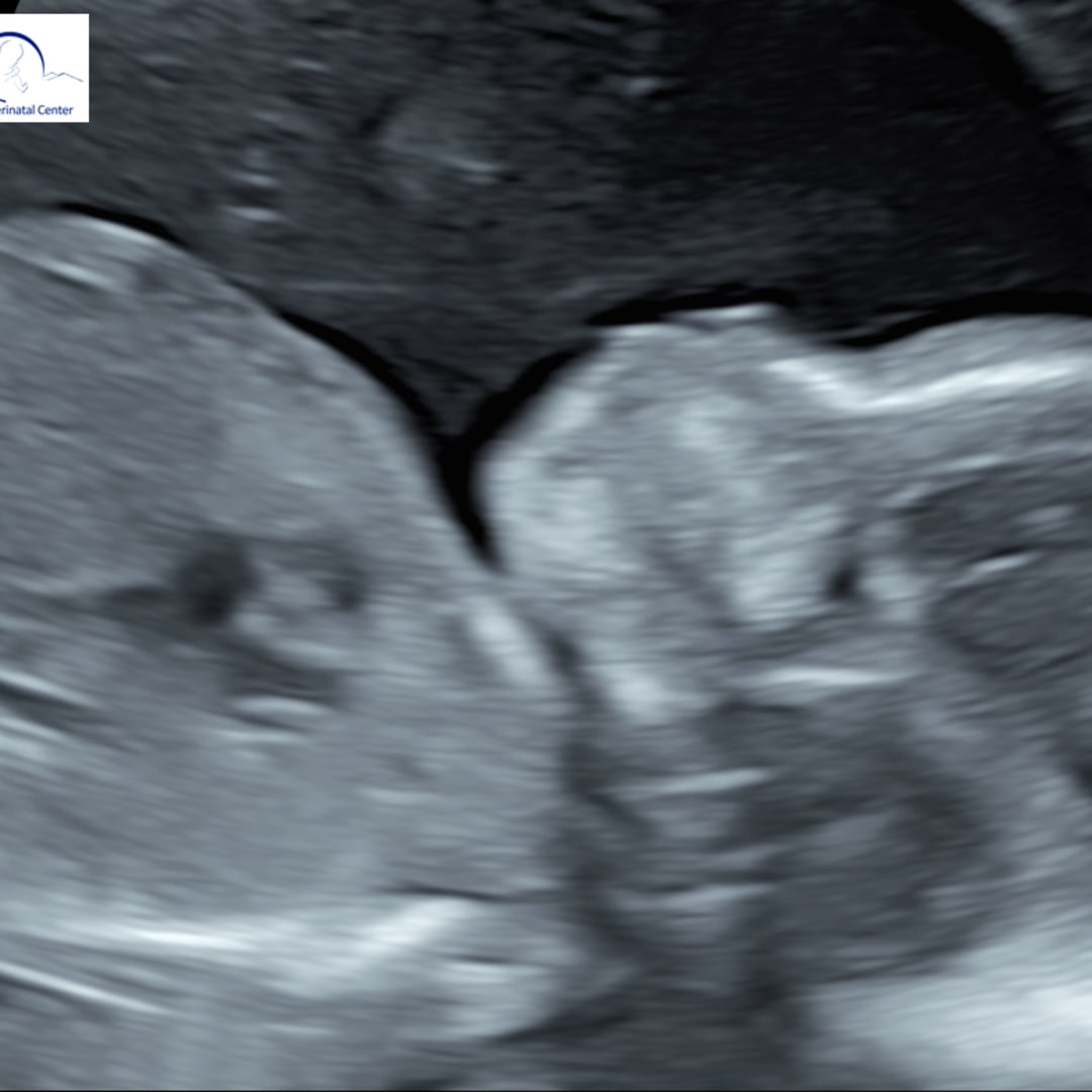 Photo shared by Daniella for their Babylist baby registry.