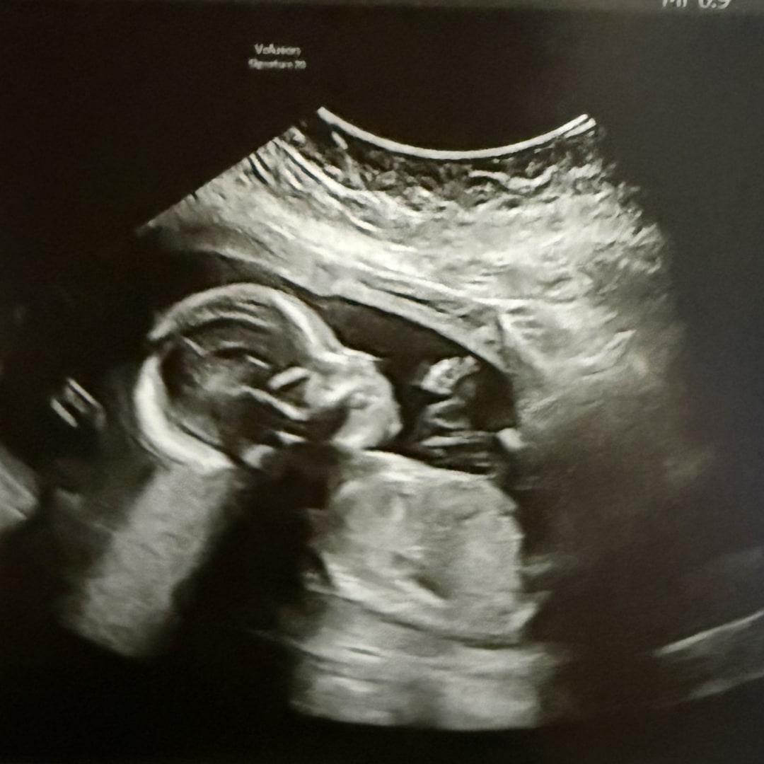 Photo shared by Bridget for their Babylist baby registry.