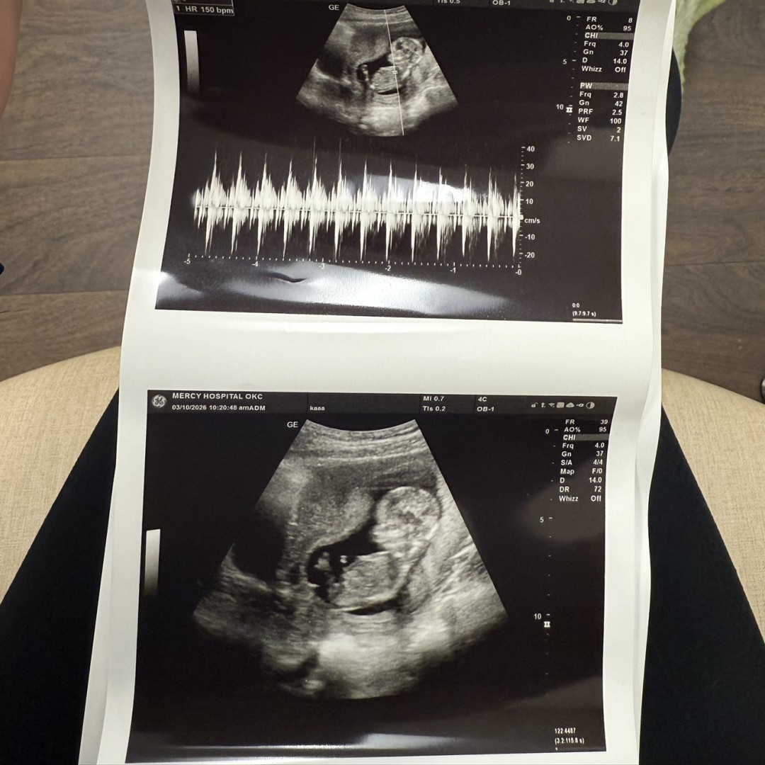 Photo shared by Heather for their Babylist baby registry.