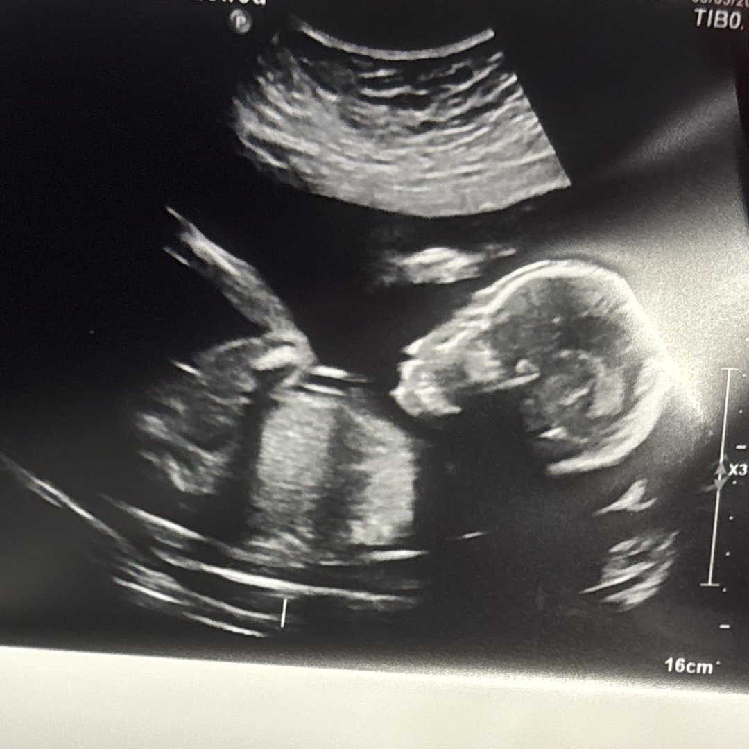 Photo shared by Hanna for their Babylist baby registry.