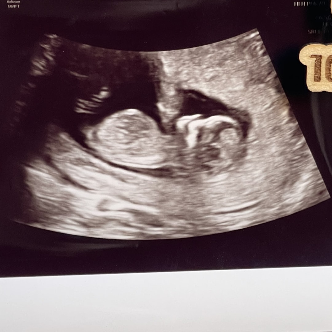Photo shared by Chiny for their Babylist baby registry.