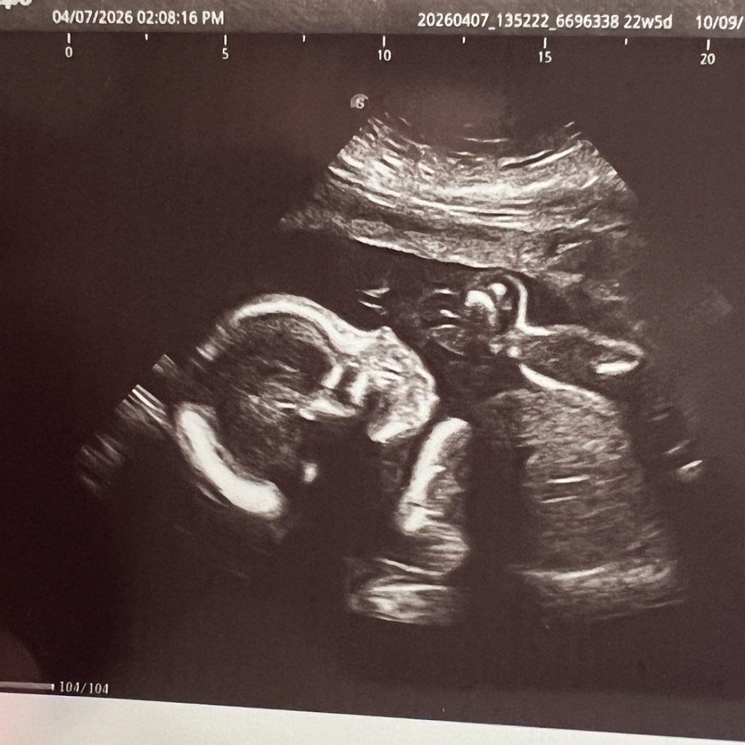 Photo shared by Sara for their Babylist baby registry.
