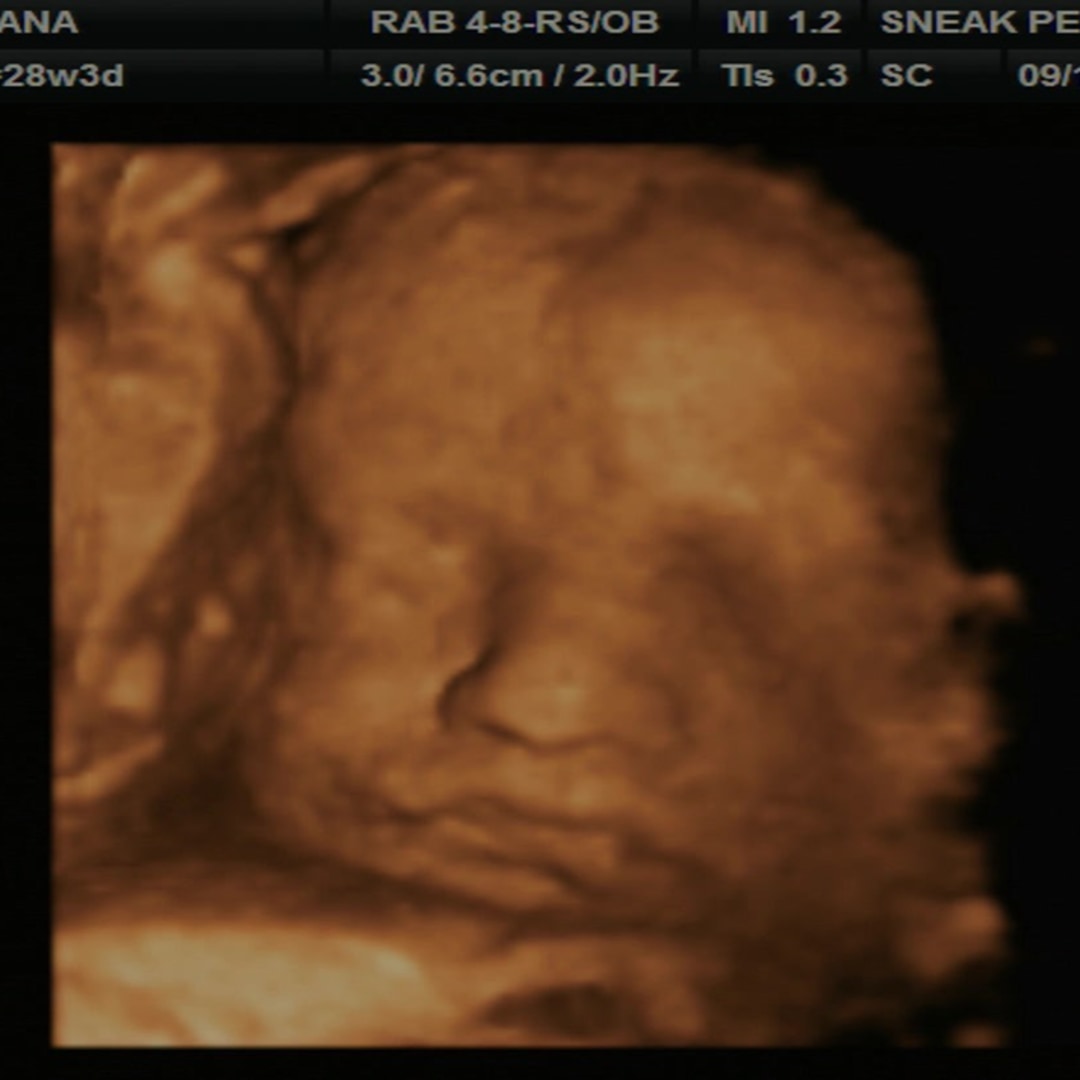 Photo shared by Breanna for their Babylist baby registry.