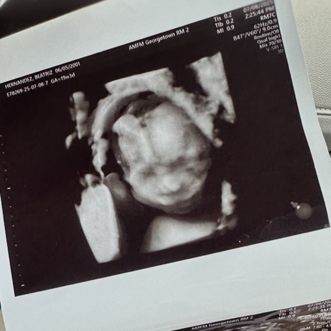 Photo shared by Beatriz for their Babylist baby registry.