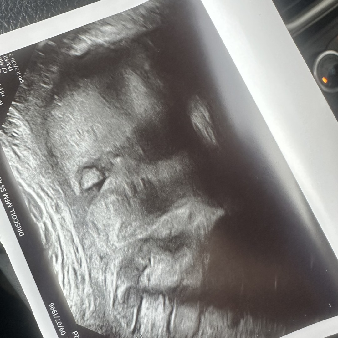 Photo shared by Rylee for their Babylist baby registry.