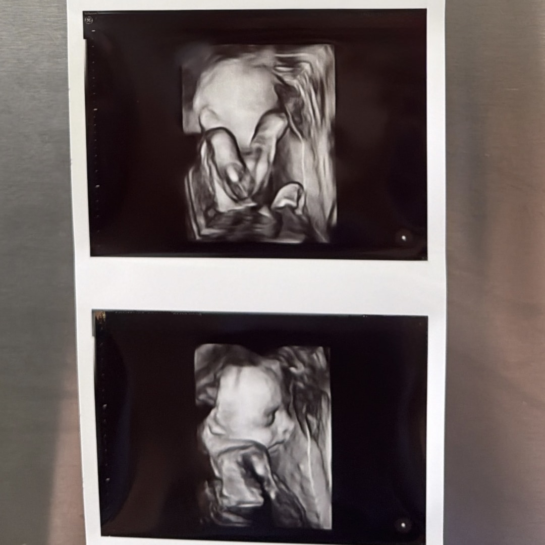 Photo shared by Brooke for their Babylist baby registry.