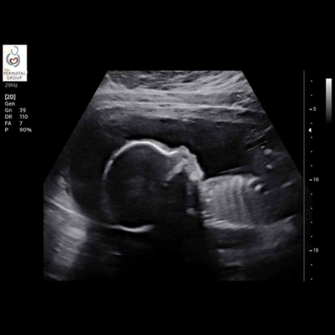 Photo shared by Aliana for their Babylist baby registry.