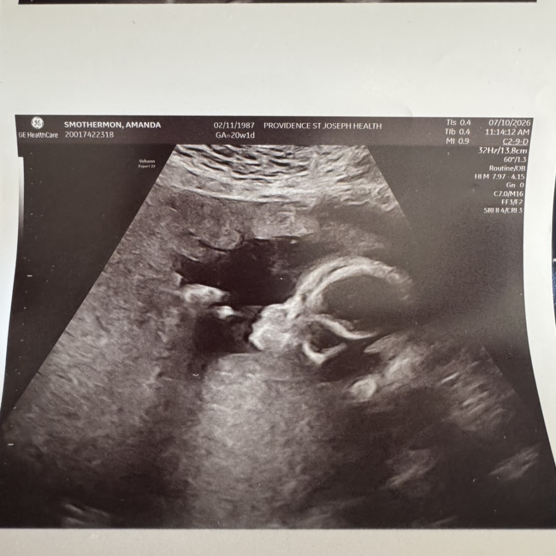 Photo shared by Amanda for their Babylist baby registry.