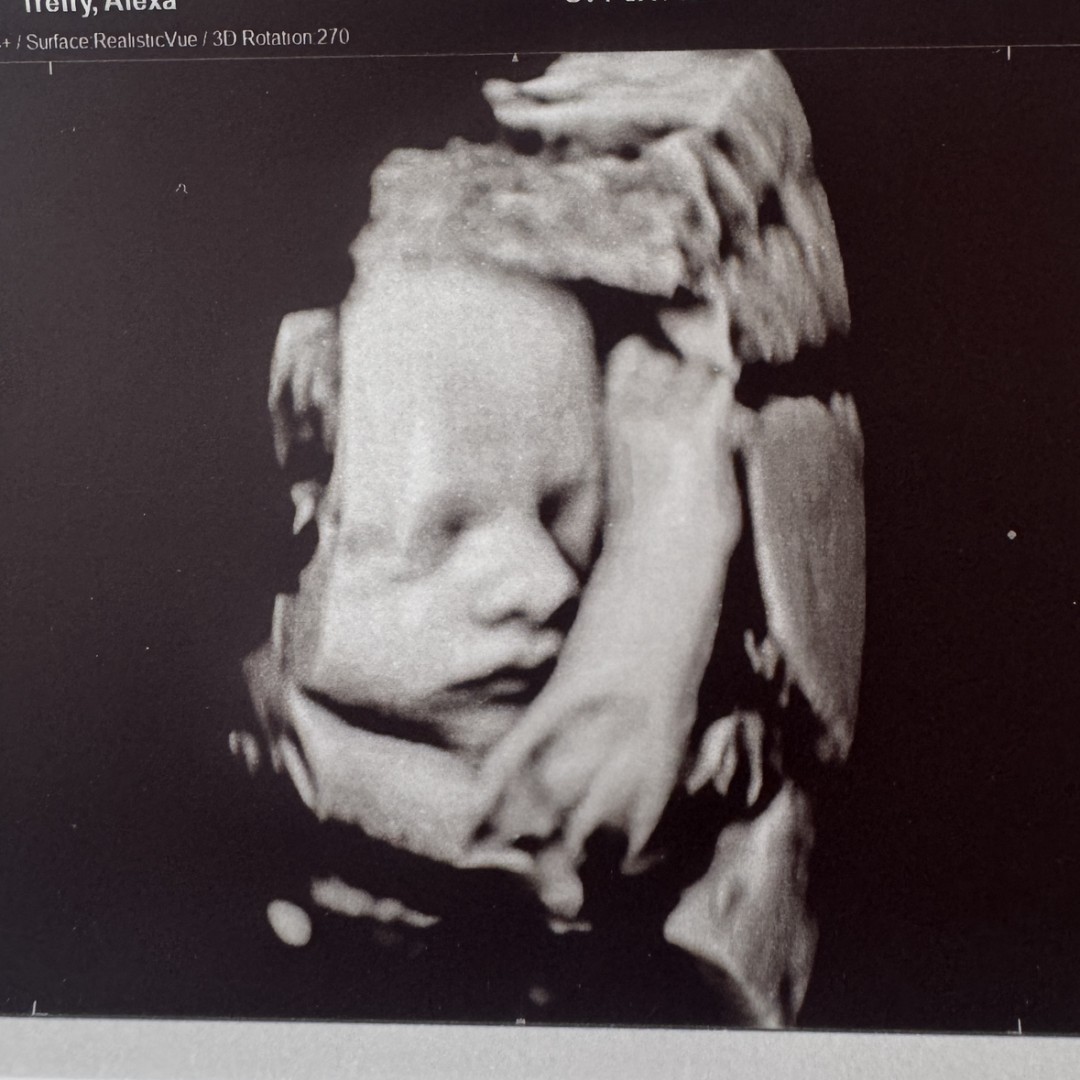 Photo shared by Alexa for their Babylist baby registry.