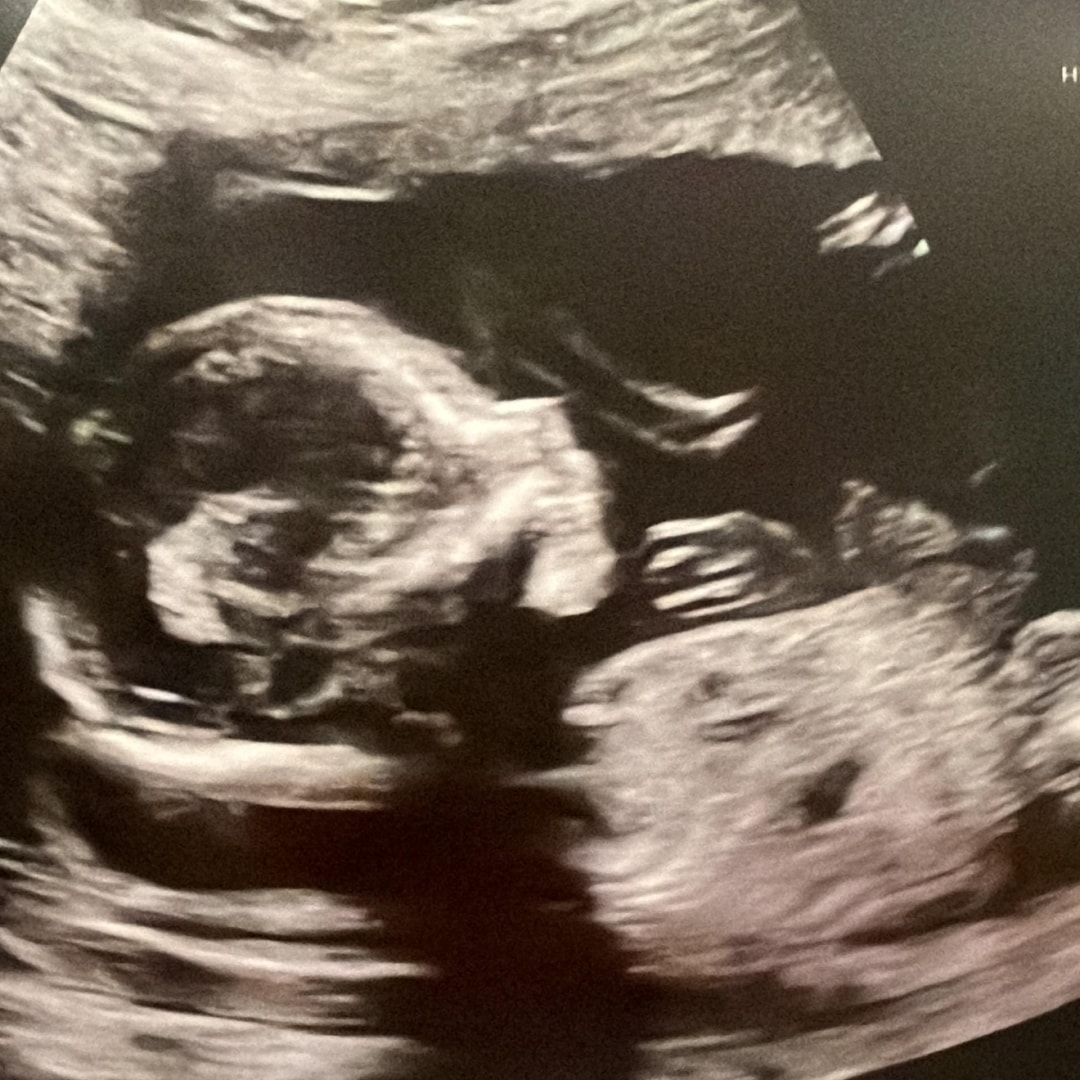 Photo shared by Cinthia for their Babylist baby registry.