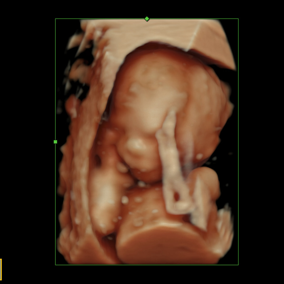 Photo shared by Cortney for their Babylist baby registry.