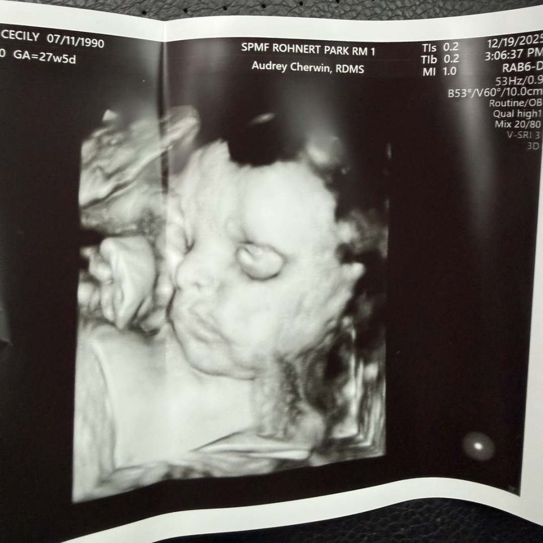 Photo shared by Cecily for their Babylist baby registry.