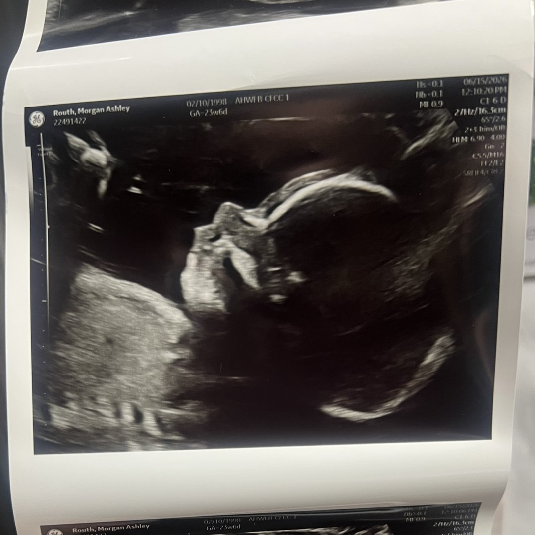 Photo shared by Morgan for their Babylist baby registry.