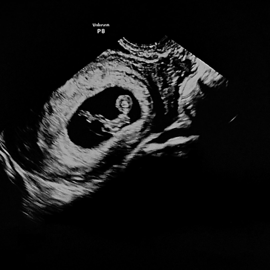 Photo shared by Tara for their Babylist baby registry.