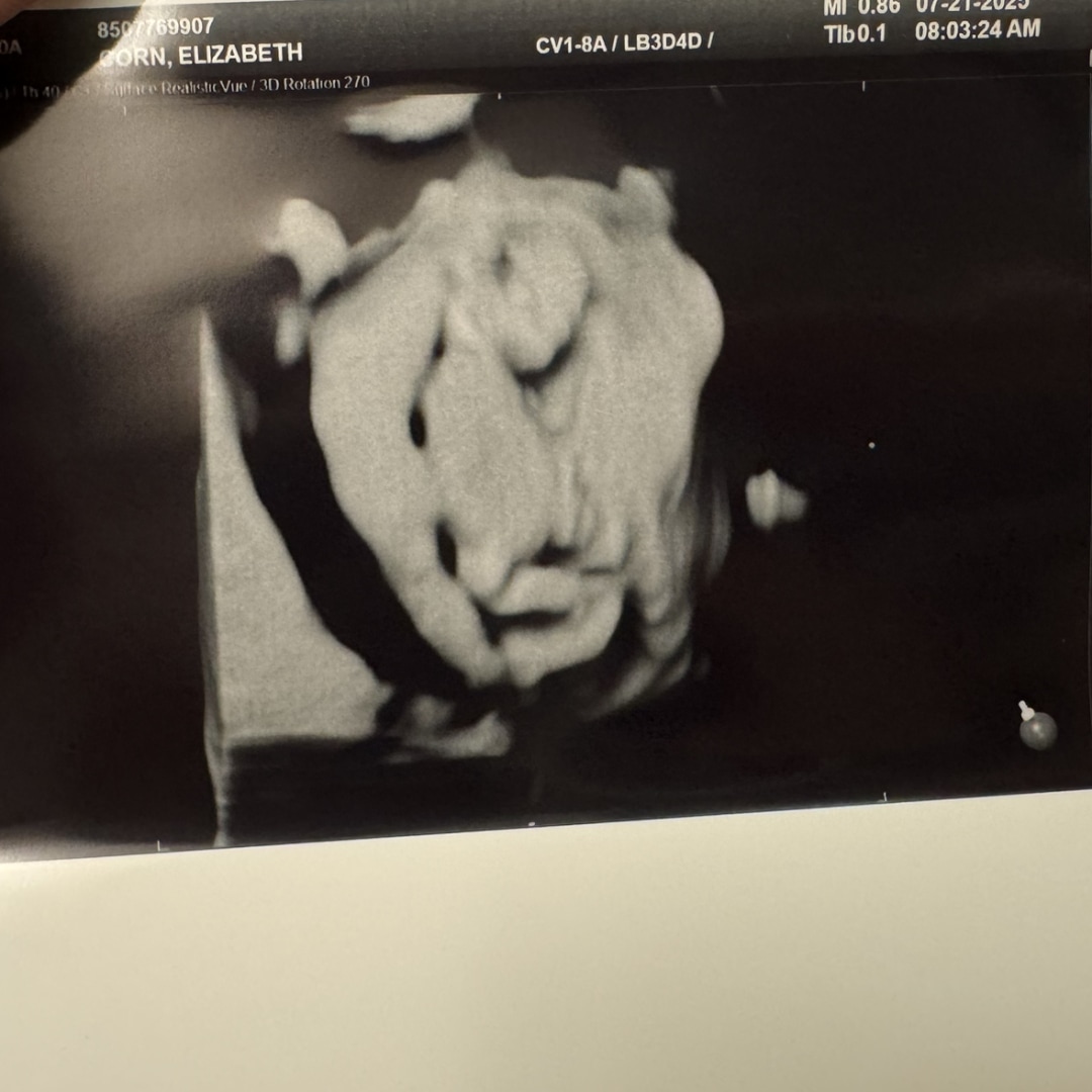 Photo shared by Elizabeth for their Babylist baby registry.
