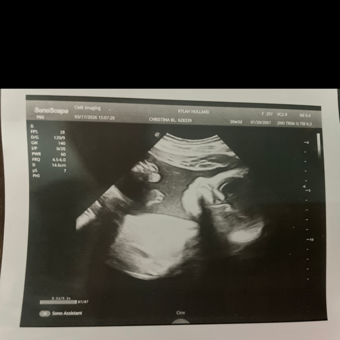 Photo shared by Kylah for their Babylist baby registry.