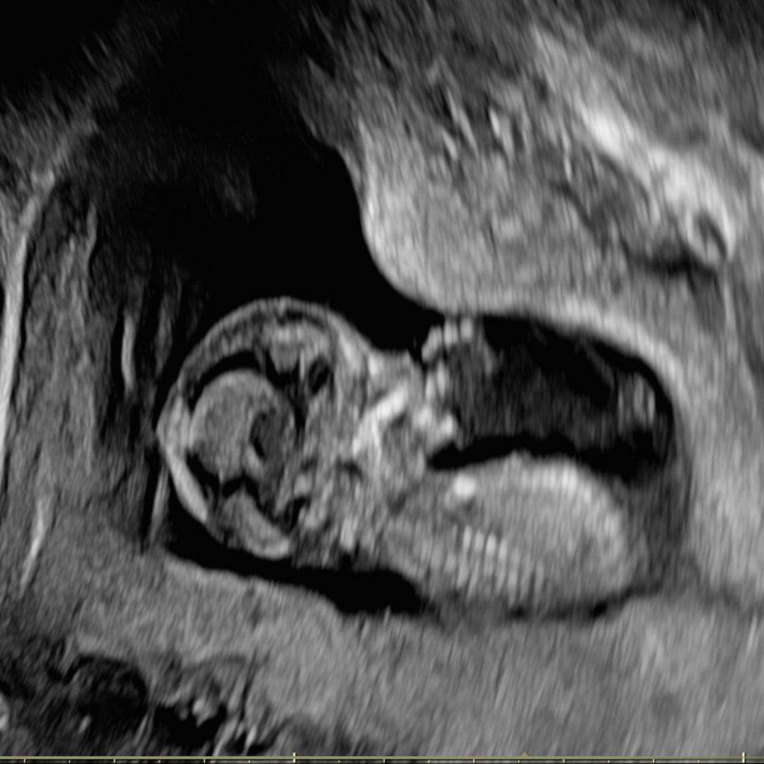 Photo shared by Faith for their Babylist baby registry.