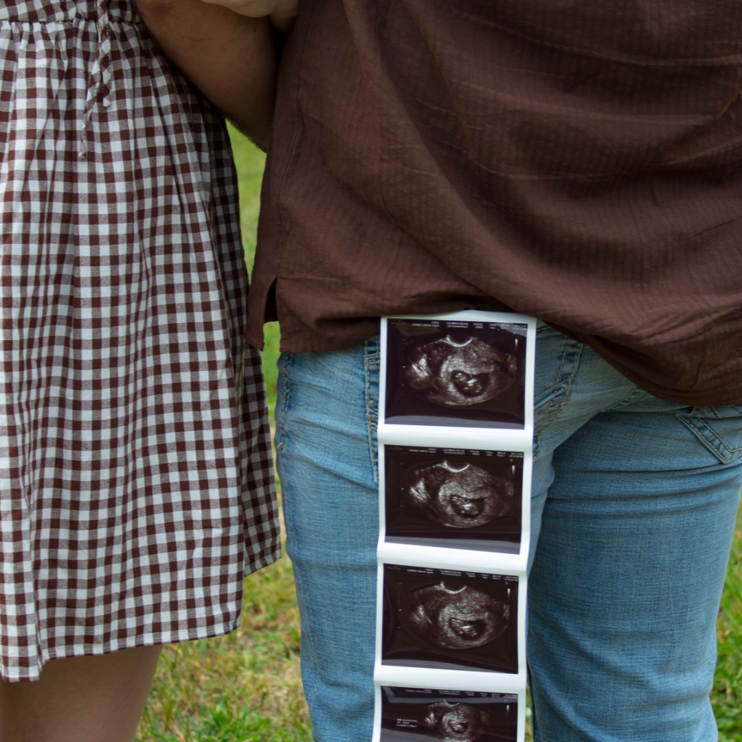Photo shared by Bailee for their Babylist baby registry.