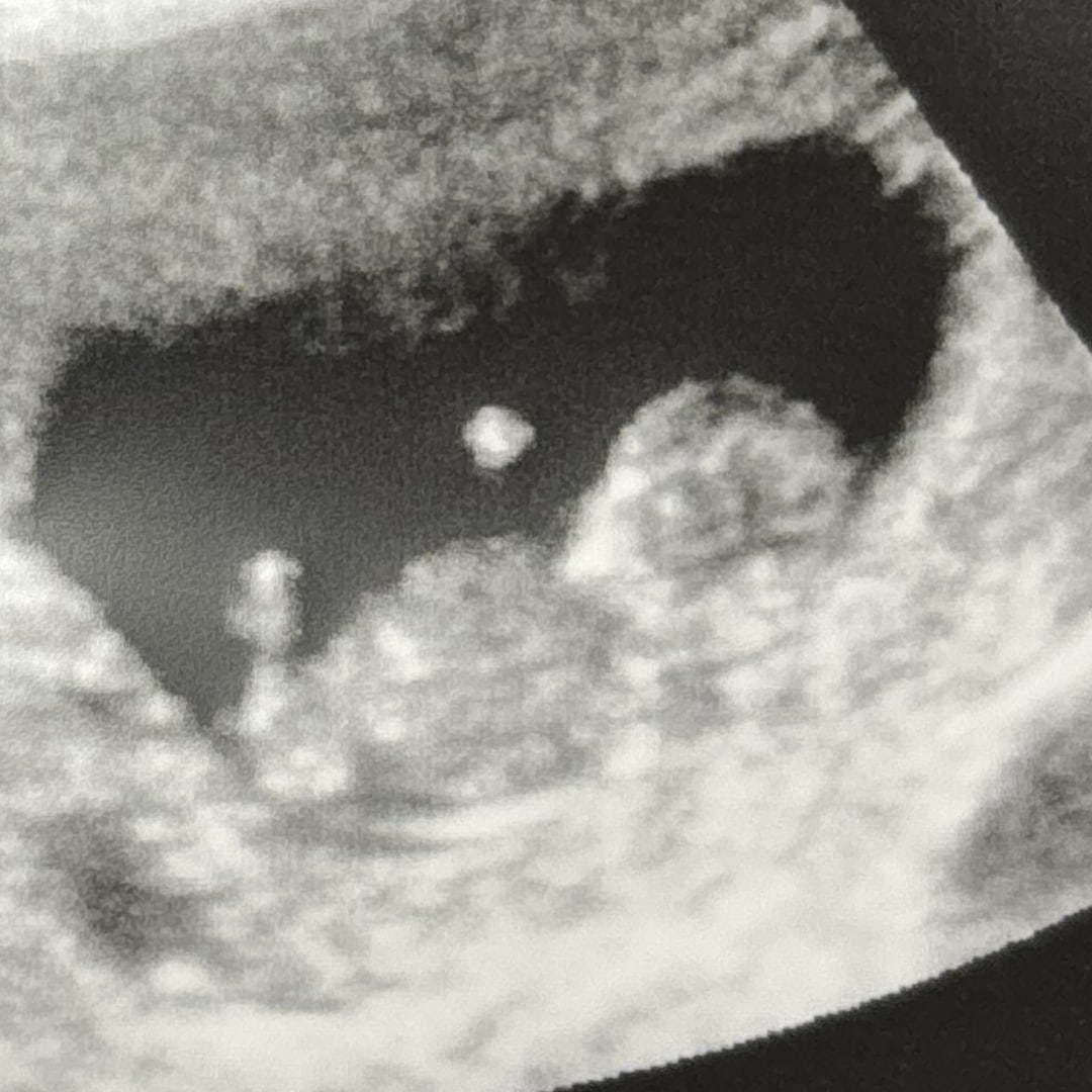 Photo shared by Ashley for their Babylist baby registry.