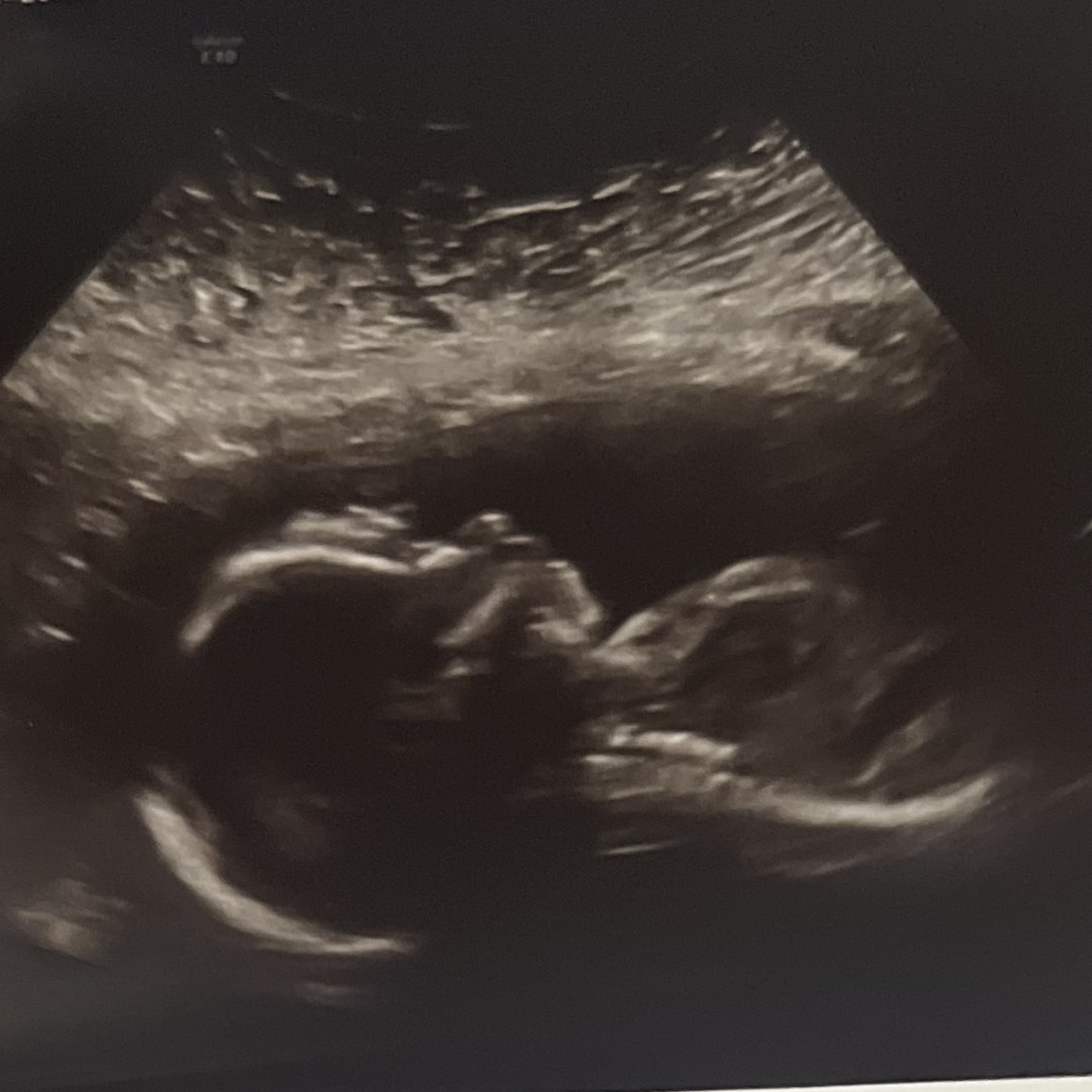 Photo shared by Mekayla for their Babylist baby registry.