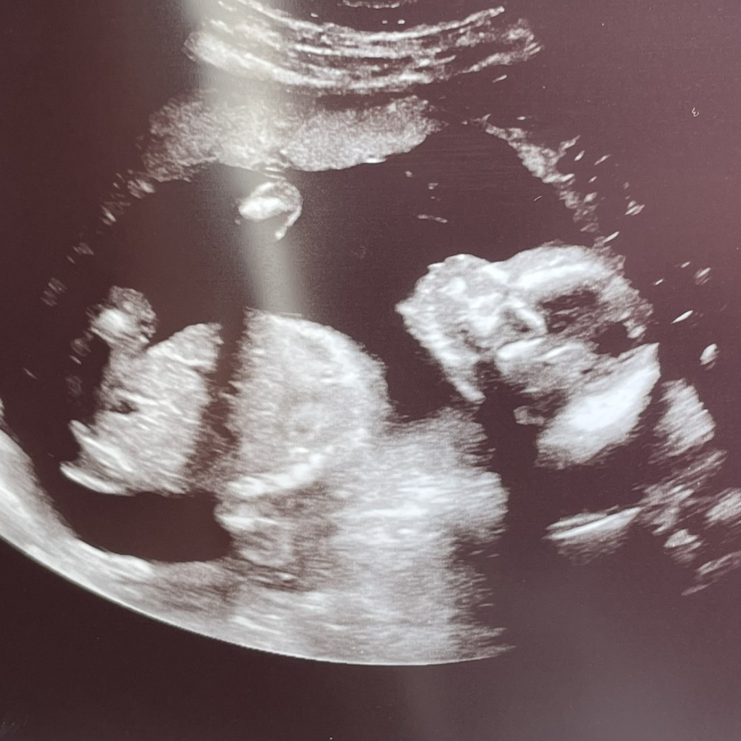 Photo shared by Andrea for their Babylist baby registry.