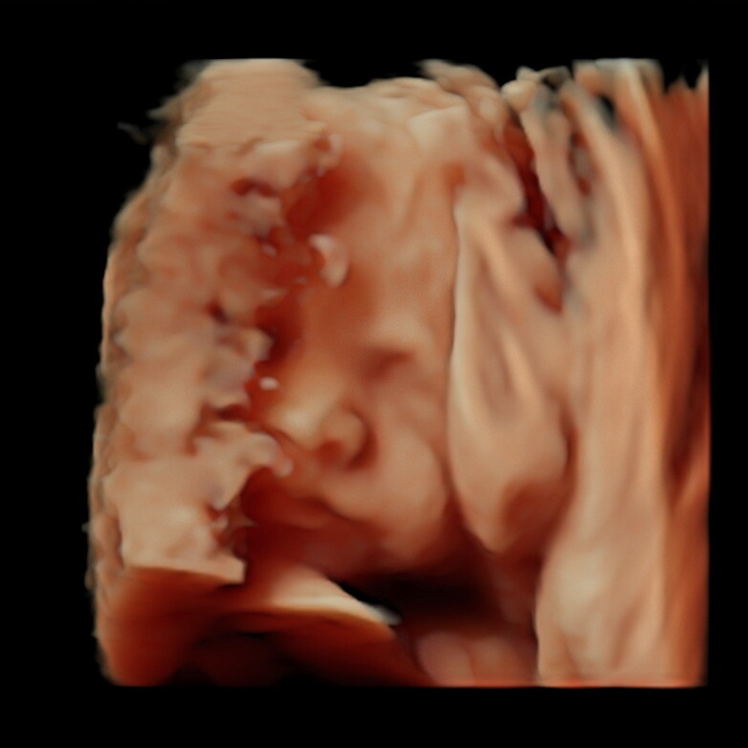 Photo shared by Addie for their Babylist baby registry.