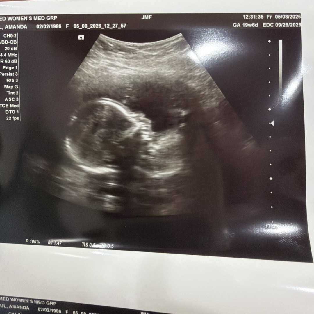 Photo shared by Amanda for their Babylist baby registry.