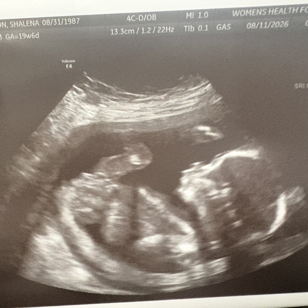 Photo shared by Shalena for their Babylist baby registry.
