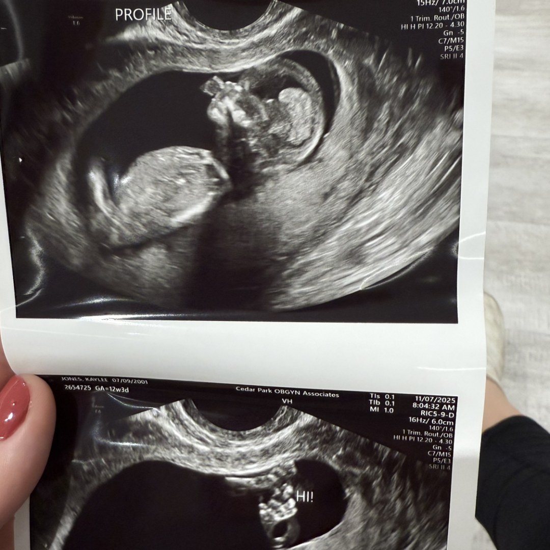 Photo shared by Kaylee for their Babylist baby registry.