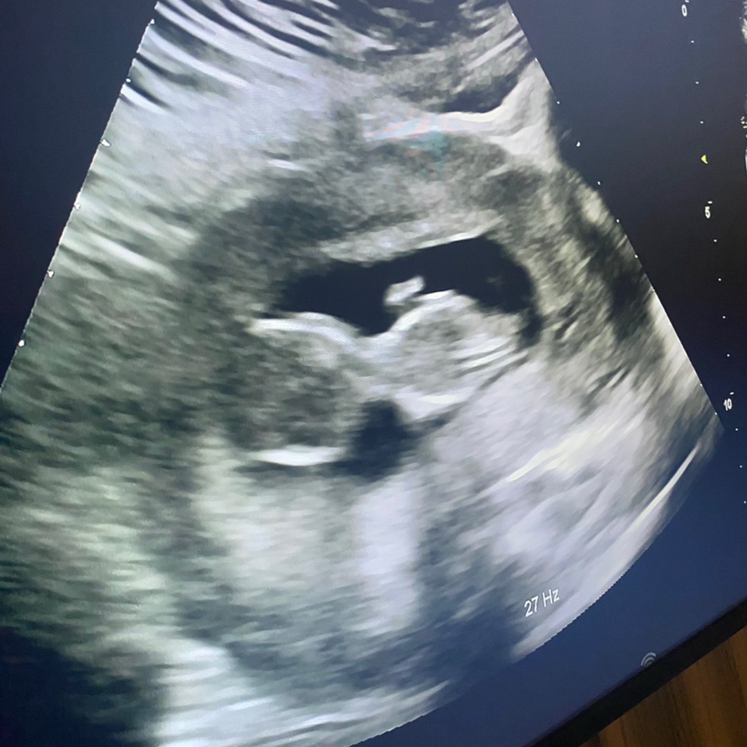 Photo shared by Jocelynn for their Babylist baby registry.