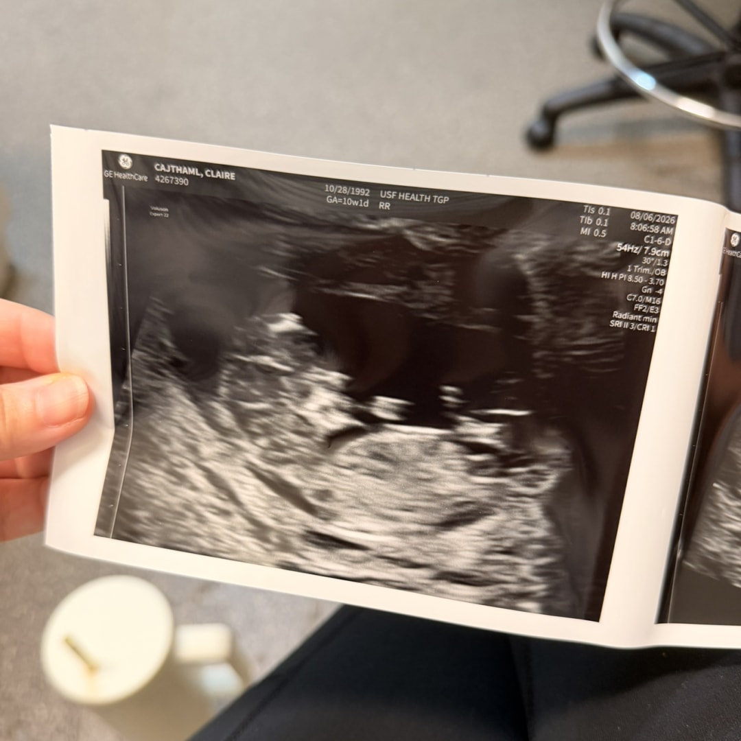Photo shared by Claire for their Babylist baby registry.