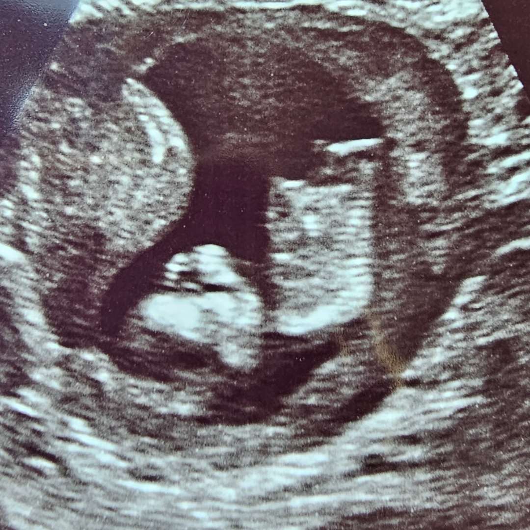 Photo shared by Dominique for their Babylist baby registry.