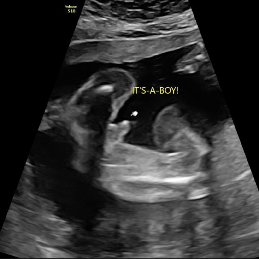 Photo shared by Claudia for their Babylist baby registry.