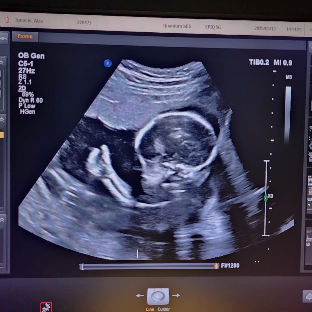 Photo shared by Aiza for their Babylist baby registry.