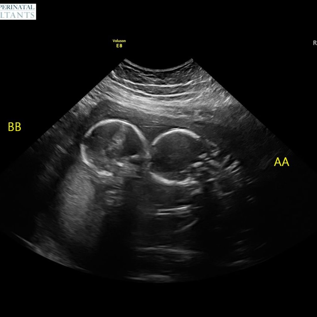 Photo shared by Jordan for their Babylist baby registry.