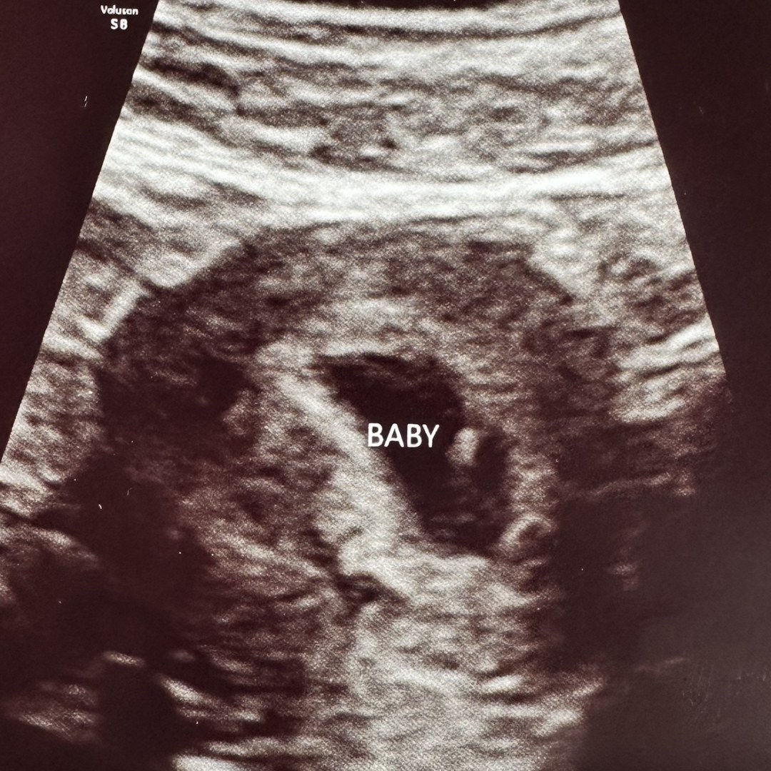 Photo shared by Hannah for their Babylist baby registry.