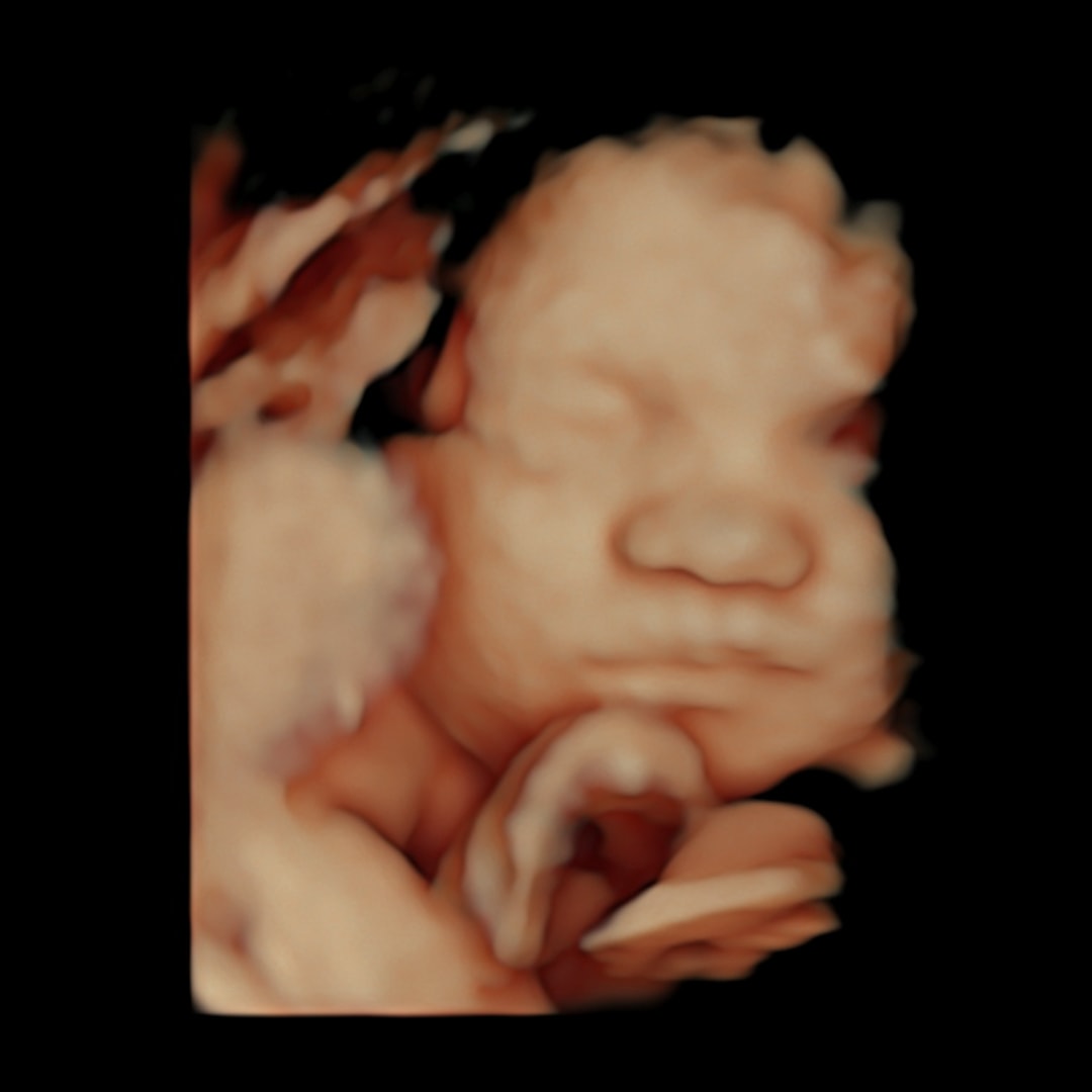 Photo shared by Mimzi for their Babylist baby registry.