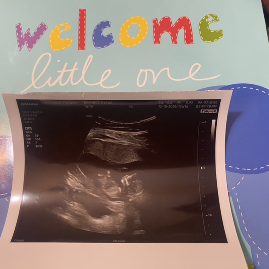 Photo shared by Alexea for their Babylist baby registry.