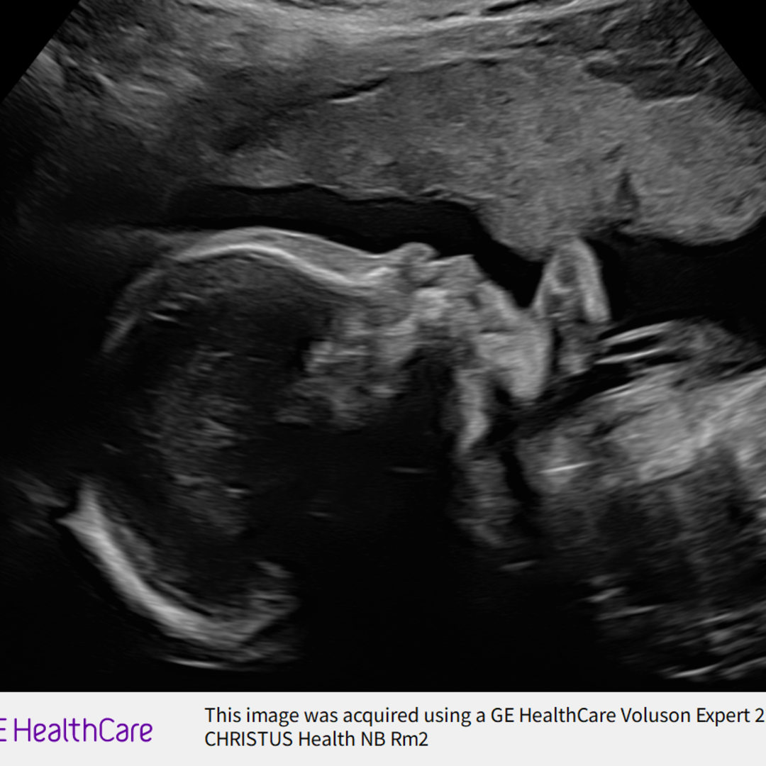 Photo shared by Jessica for their Babylist baby registry.