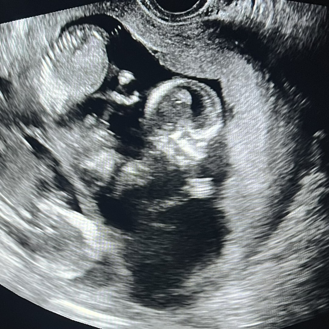 Photo shared by Ariana for their Babylist baby registry.